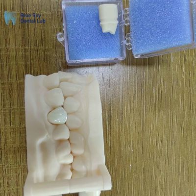 acheter Restaurations dentaires esthétiques en zircone Couronnes en porcelaine en zircone online manufacture