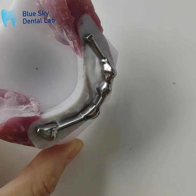 acheter Barre de titane dentaire personnalisable avec dents d'abutment pour prothèse dentaire online manufacture
