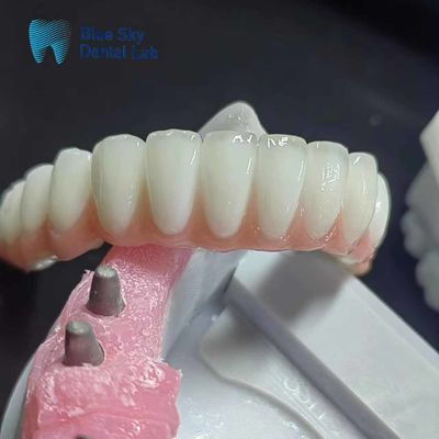 acheter Cas d'implants dentaires en zirconium ordinaire Cas d'implants dentaires personnalisés online manufacture