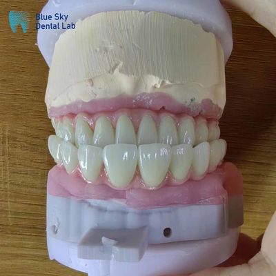 acheter Implants dentaires artificiels à arc complet Cas d'opération pour les procédures chirurgicales online manufacture