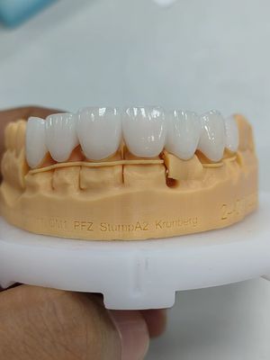 acheter 5 mm-6 mm couronnes en zirconium en couches Résistance couronne en zirconium en couches multiples online manufacture
