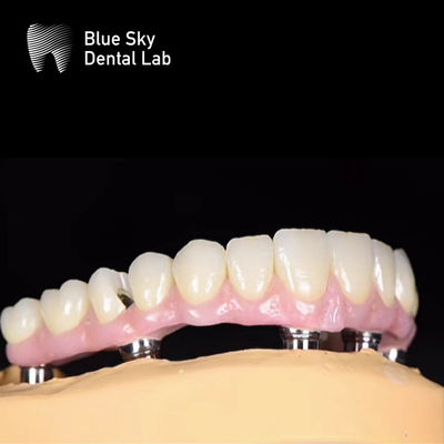 acheter Cas d'implant dentaire à choix multiples online manufacture
