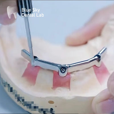 acheter Barre de titane dentaire de précision avec accessoire précieux Biocompatible online manufacture