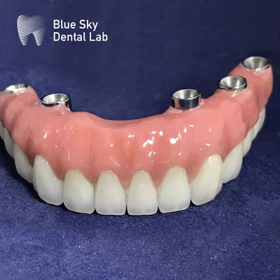 acheter Implants rectangulaires autoclavables universels surface lisse couleur argentée online manufacture