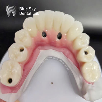 acheter Casques d'implants dentaires à arc complet compatibles avec plusieurs systèmes d'implants online manufacture