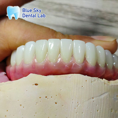 acheter Compatibilité universelle Casse d'implant personnalisée Casse d'implant de bouche complète online manufacture