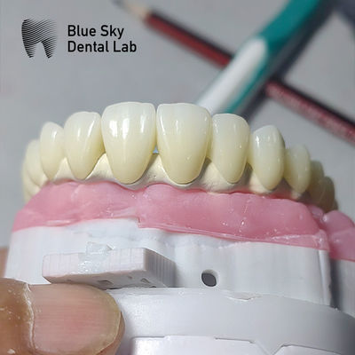 acheter Casque d'implant dentaire universel compatible avec plusieurs systèmes d'implant online manufacture