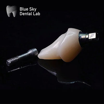 acheter Implantation en titane hypoallergénique avec abutment en zirconium Système d'implantation bleu ciel online manufacture