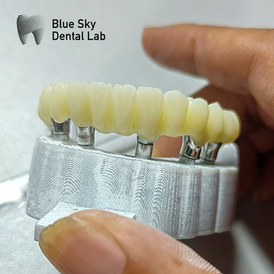 acheter Cas d'implant de pont PMMA pour les scénarios d'implantation de surface lisse online manufacture