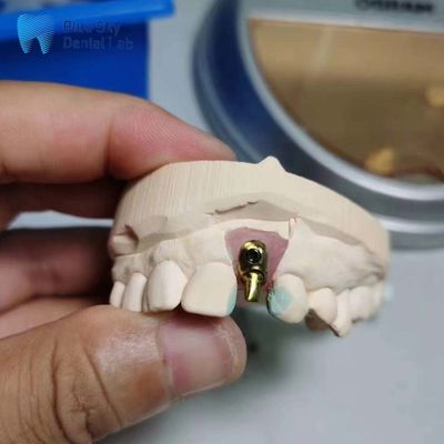 acheter Casse d'implant régulière personnalisable d'implant unique Dent Offset Arch Casse d'implant online manufacture