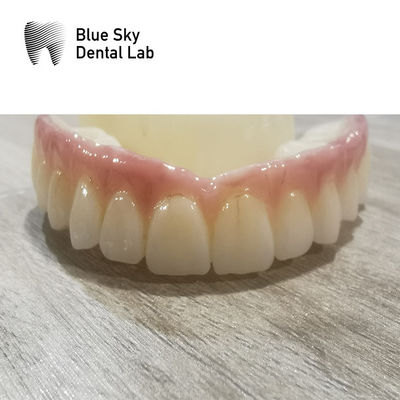 acheter Compatibilité Cases d'implants Système d'implants ordinaires Cases dentaires online manufacture