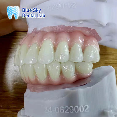 acheter Cas d'implant à arc complet personnalisé Cas d'implant universel online manufacture