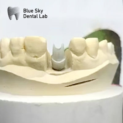 acheter Implantation esthétique en zirconium d' abutment Biocompatible précision fraisée online manufacture