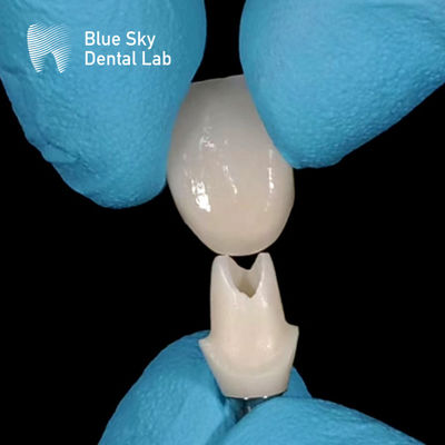 acheter Scanner oral Abutment en zirconium personnalisé Abutments en zirconium à haute résistance online manufacture