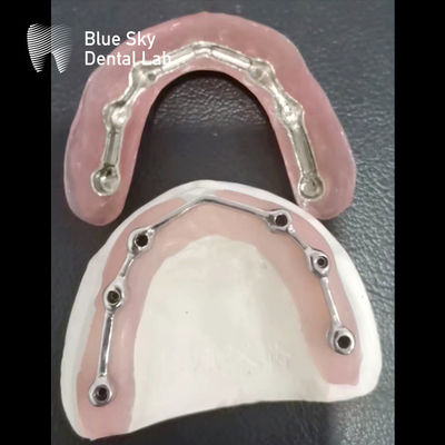 acheter Barre de titane dentaire avec prothèse acrylique complète Barre de titane pour implants dentaires online manufacture