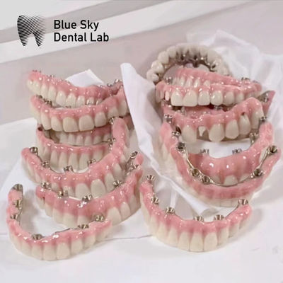 acheter Cas d'implant Blue Sky avec un pont en titane pur online manufacture