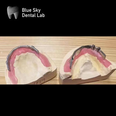 acheter Implants dentaires Blue Sky Bar de titane argenté Pour les implants dentaires online manufacture