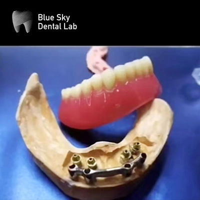 acheter Barre de titane dentaire à bouche pleine restauration précise de la prothèse amovible online manufacture