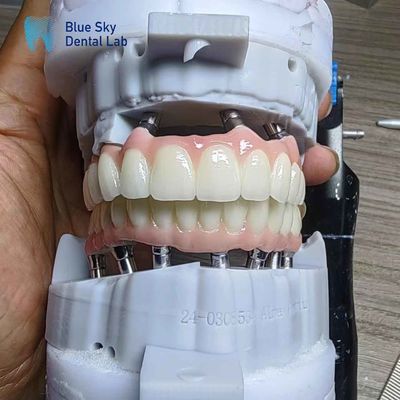 Implantation en zirconium en couches personnalisée