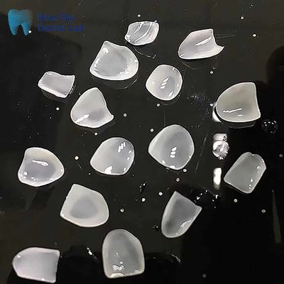Veneurs ultra-minces E Max de classe ingot, céramiques à l'aspect naturel