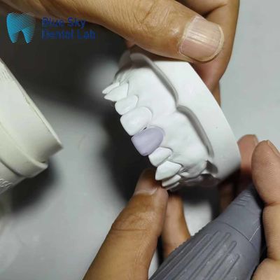 0Implants de placage en verre céramique mince de.3 mm Cas de placage léger
