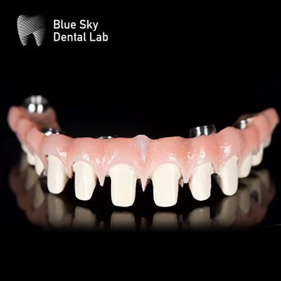 Système d'implants dentaires de titane pur de type Malo Bridge