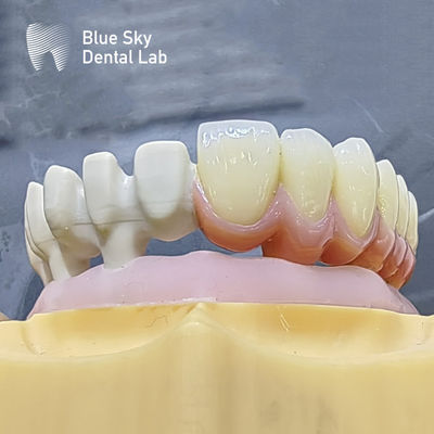 Personnalisez les boîtiers d'implants de couleur avec une surface lisse