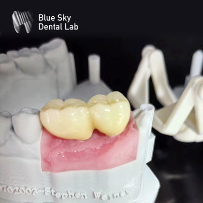 Cas d'implants à surface lisse Stérilisation à la vapeur Cas d'implants dentaires