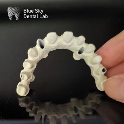 Ponte en titane à cadre de Malo Dental Ponte d'implant de Malo personnalisée