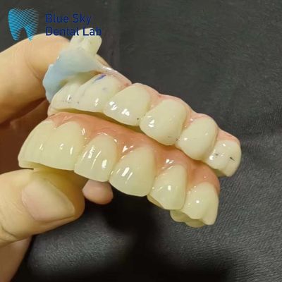 Cas d'implantation cas d'implantation artificielle pour une compatibilité sans couture du système