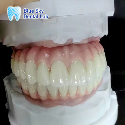 Cas d'implant dentaire ordinaire Nature et durabilité pour les équipements médicaux