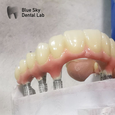 Forme naturelle Enveloppe d'implant à pleine voûte Enveloppe d'implant dentaire à surface lisse