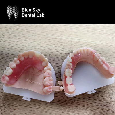 Cas de procédure d'implants plastiques La solution ultime pour l'organisation et le transport des implants dentaires