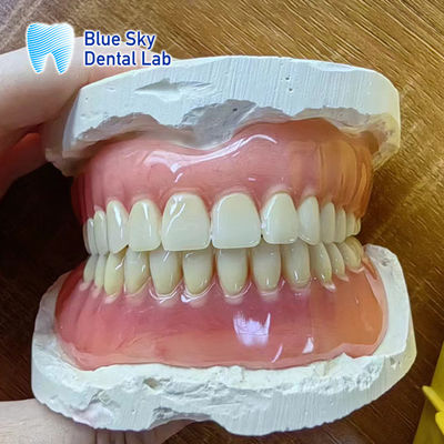 Les dents manquantes La restauration de la prothèse complète en acrylique