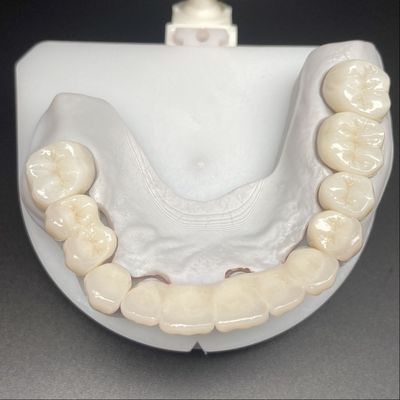 Pont en zirconium en couches pour une restauration fixe Beaux sourires Stable professionnel