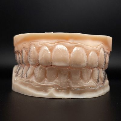 Des dents personnalisables, des aligneurs invisibles, des accolades claires et un temps de traitement plus court