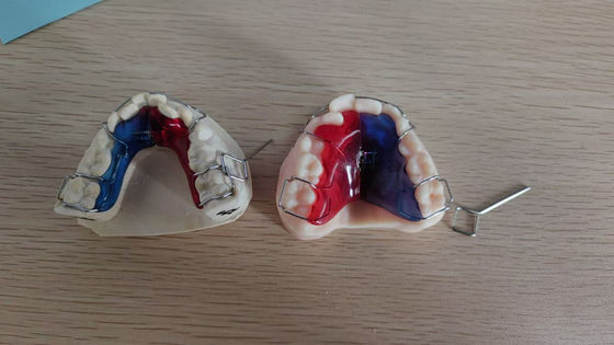 Cas d'implant dentaire de haute durabilité Cas d'implantation artificielle pour les professionnels dentaires