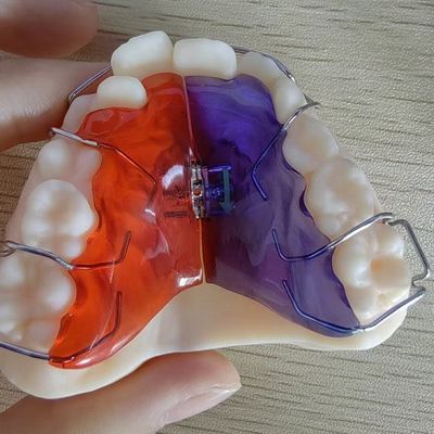 Scénarios d'implantation plastique à surface lisse pour solutions personnalisées